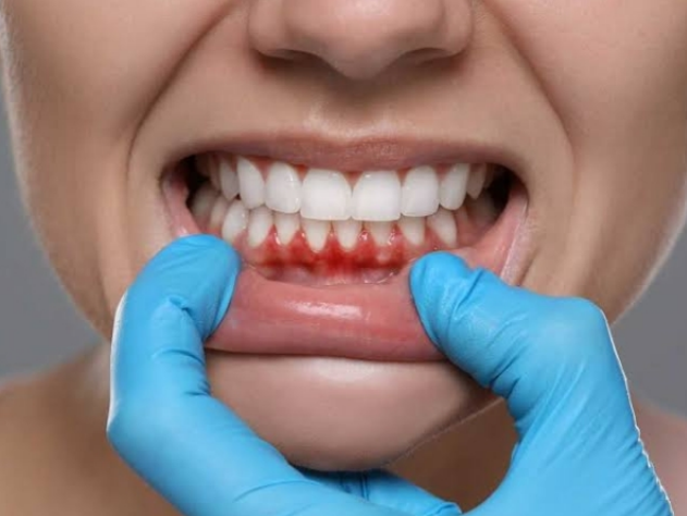 Tinh dầu cam được sử dụng trong một số sản phẩm chăm sóc răng miệng