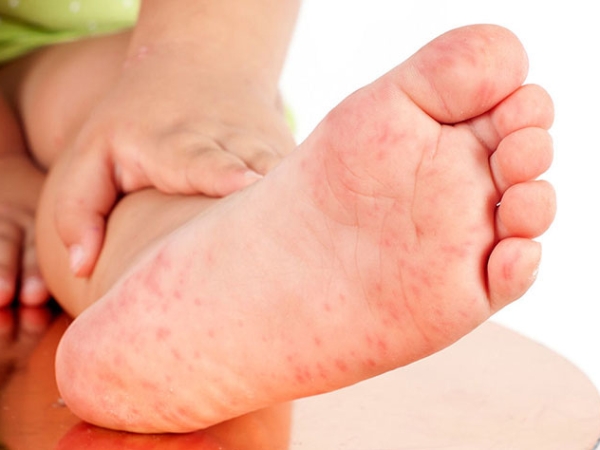 Tinh dầu húng chanh thường dùng cho trẻ uống giúp tăng cường sức đề kháng