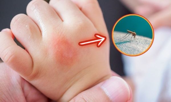 Tinh dầu tràm có đuổi muỗi không theo khoa học chứng minh