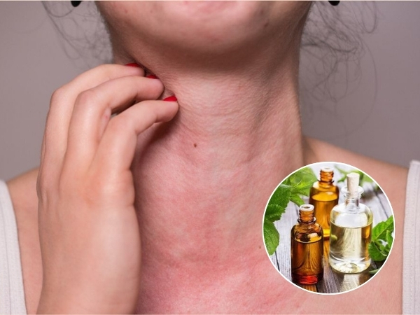 Nếu da xuất hiện cảm giác đỏ ngứa nên ngừng sử dụng tinh dầu ngay